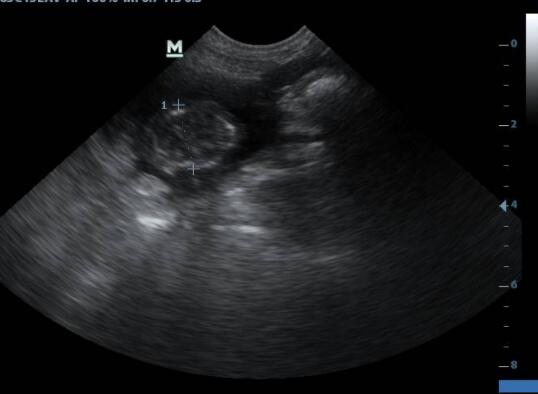犬、猫用宠物B超做妊娠监测的方法和步骤