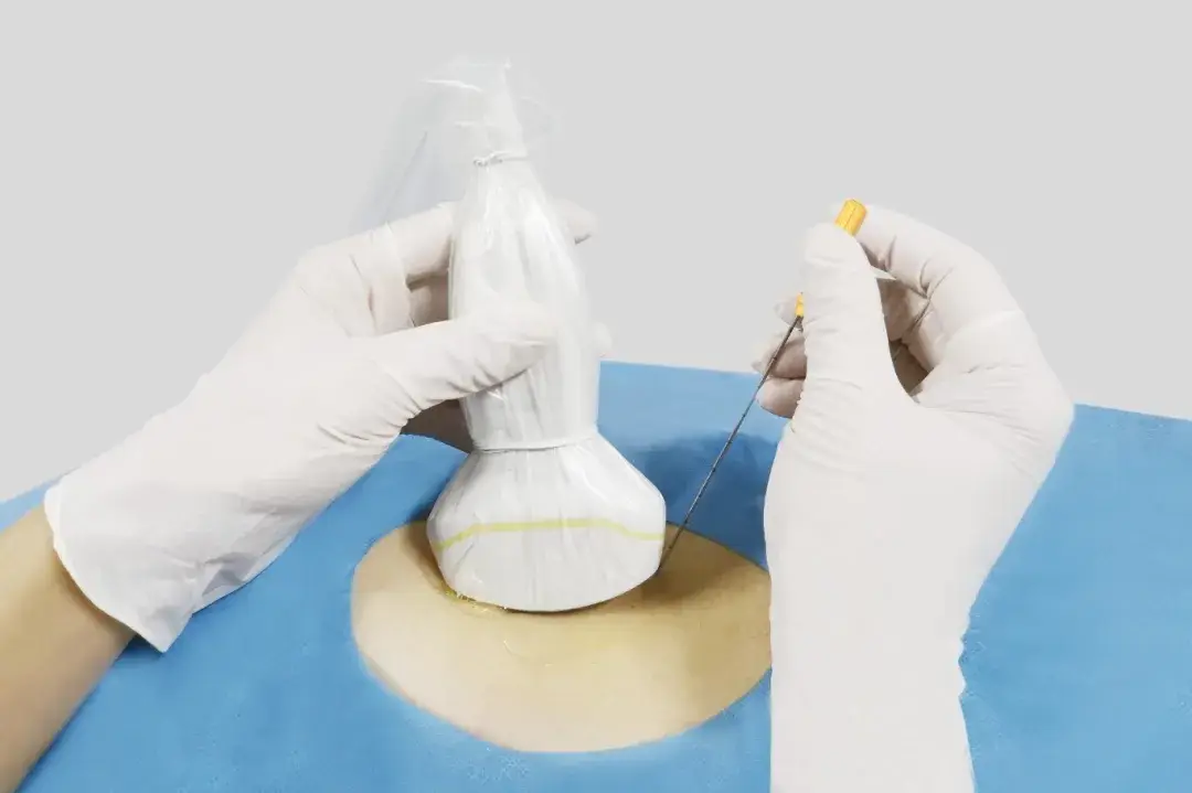 彩超穿刺引导操作方法