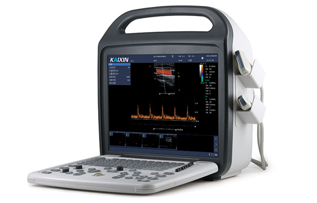 DCU10 便携彩超机,彩超机多少钱一台